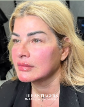 Signature Antigravity Lift™